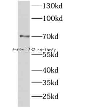 Anti- TAB2 antibody - Click Image to Close